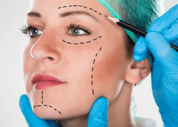 Professional Plastic Surgery - Insights and Considerations