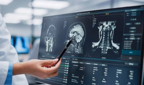 digital radiography